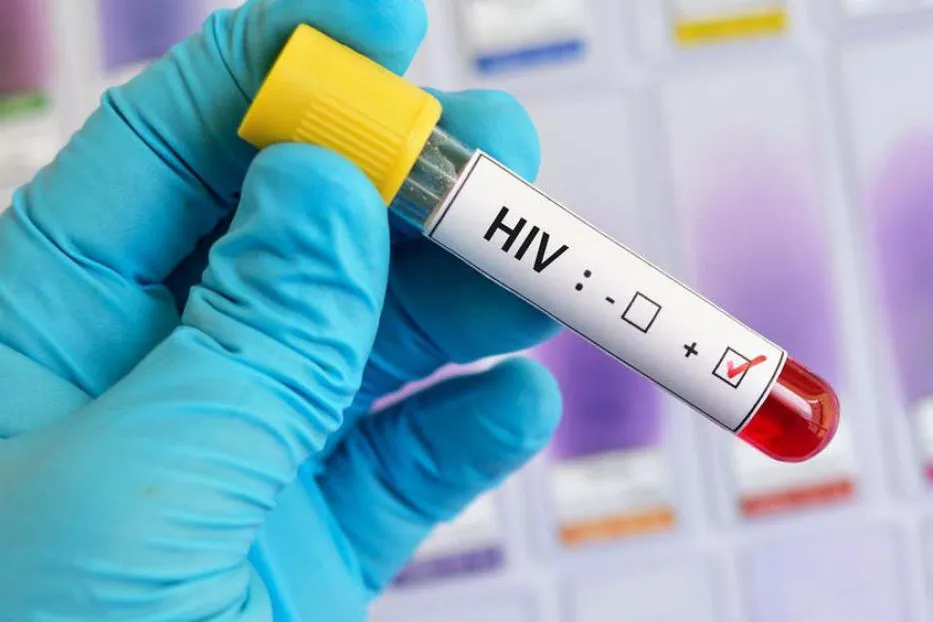 hiv