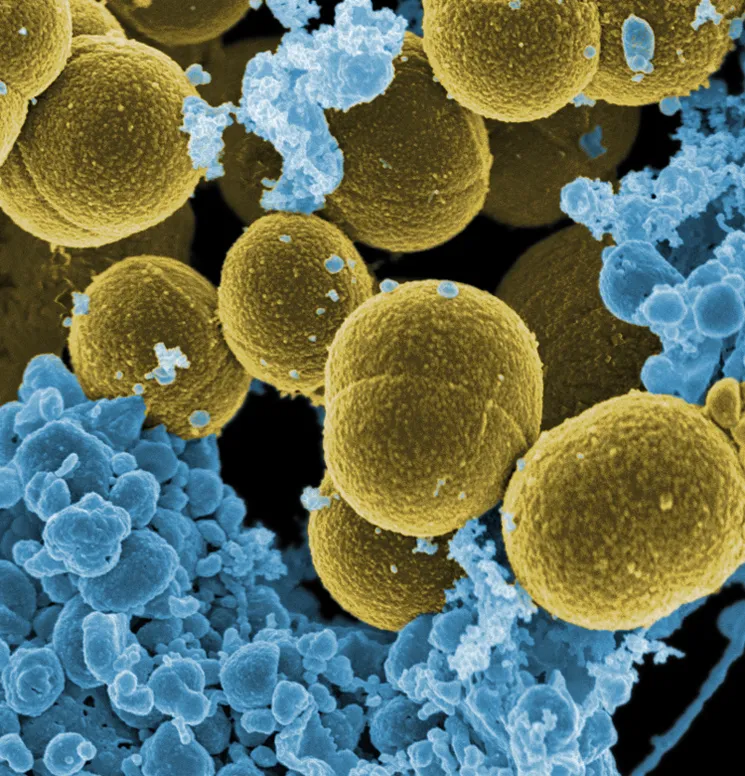 Staphylococcus_aureus_bacteria_escape