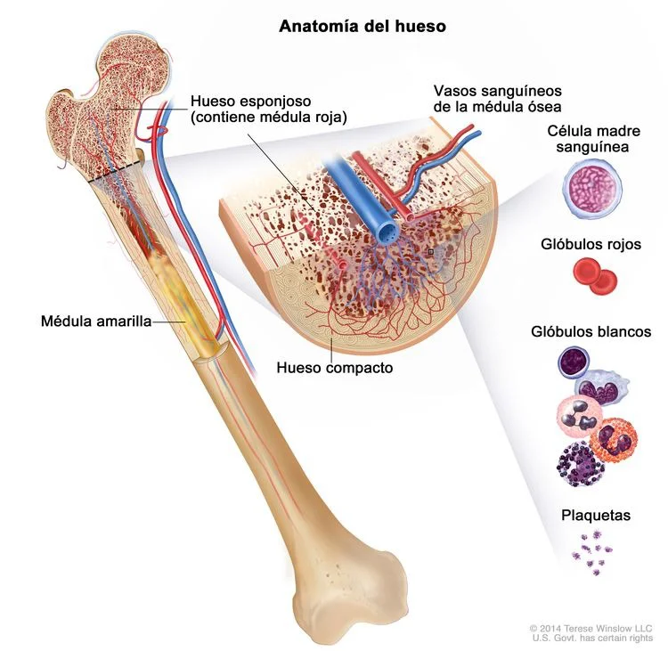 Leucemia