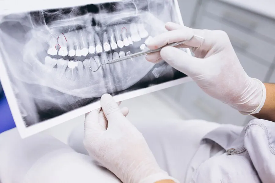 radiografia-dientes_1303-9353